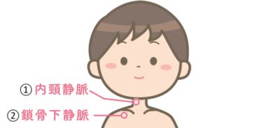 IVH挿入場所